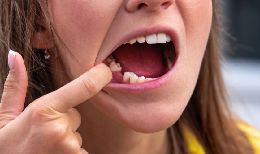 Missing Teeth? Fixed Bridges Restore Your Smile!