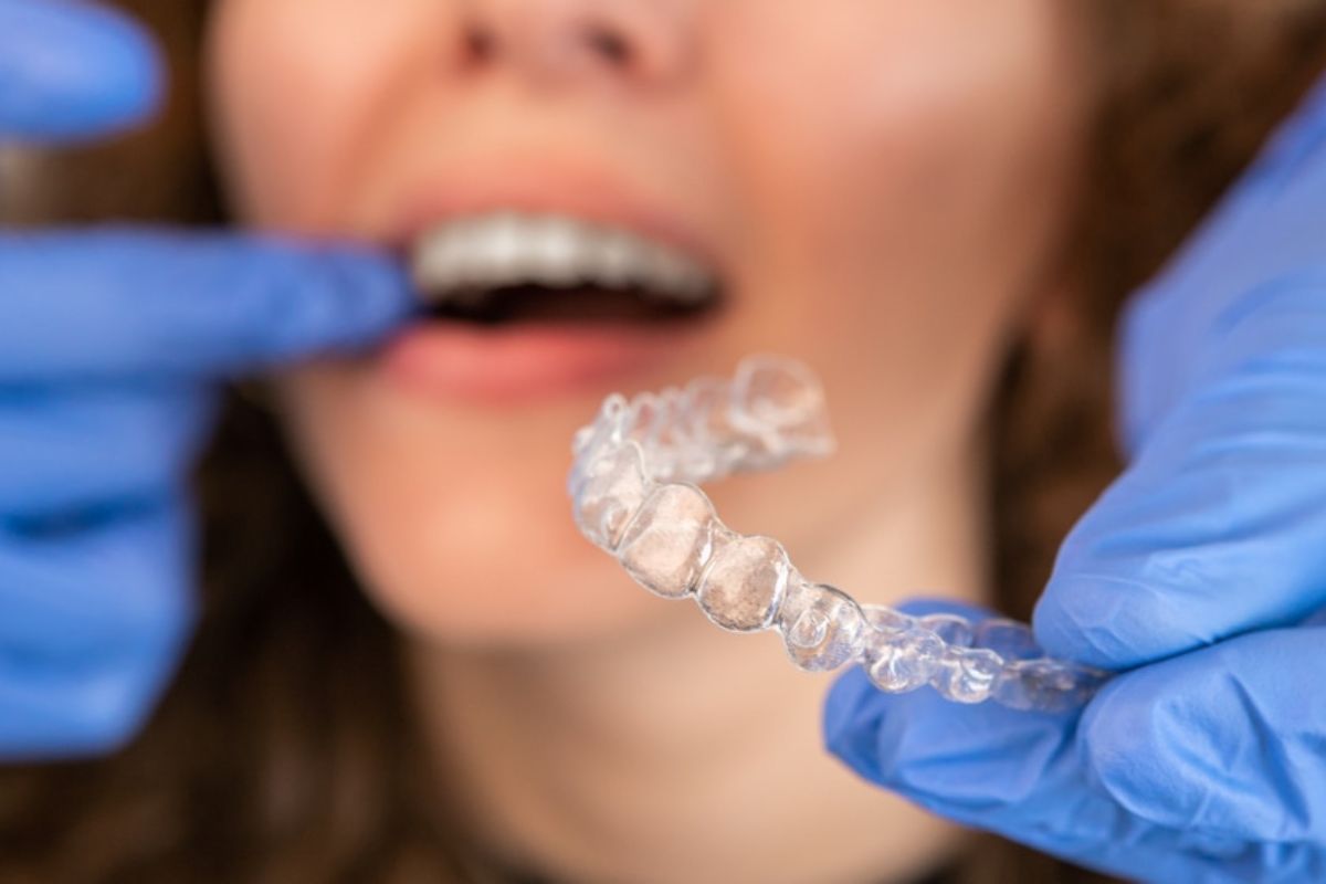 Correcting Gaps in Teeth with Invisalign