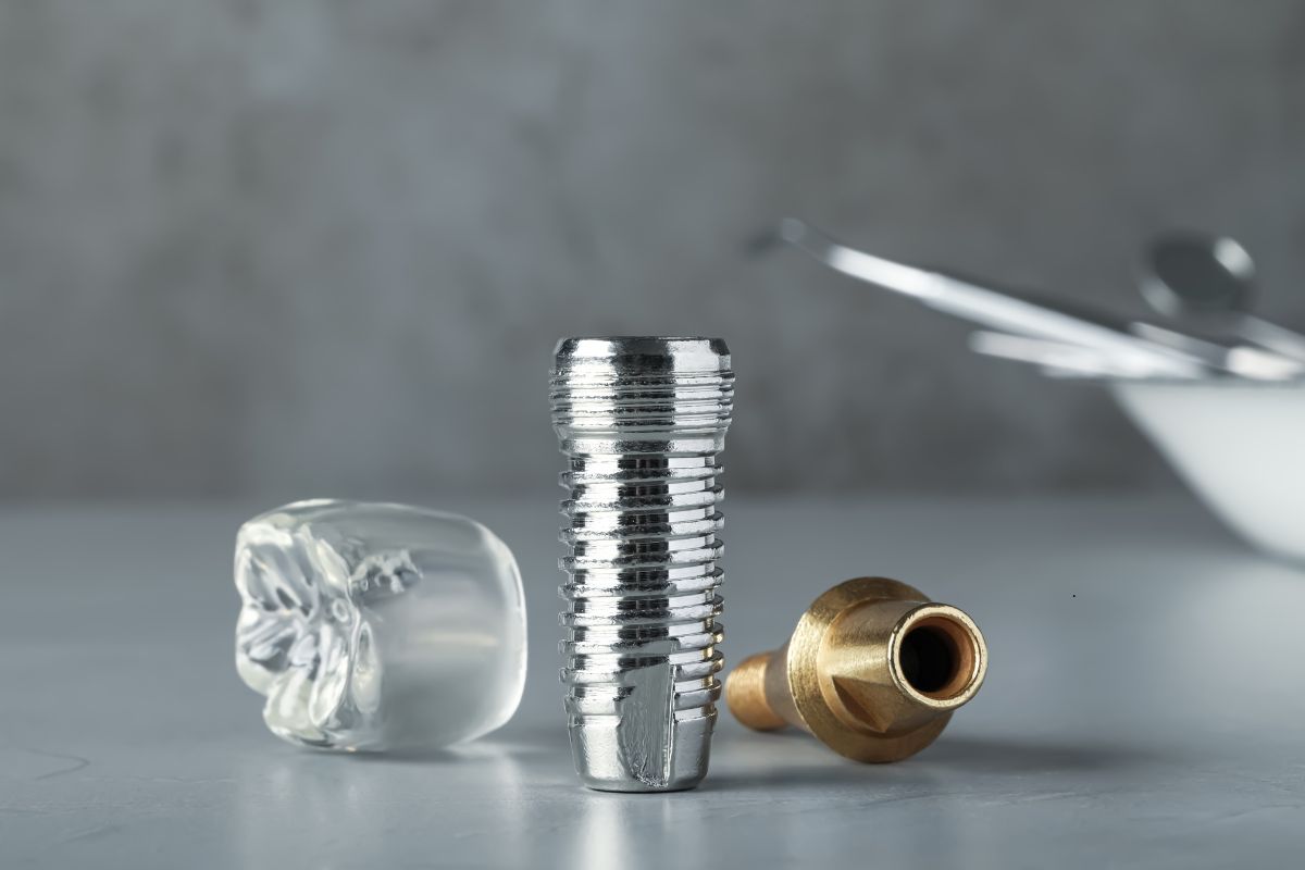 How to Maintain Dental Implants: Tips to Detect and Prevent Complications