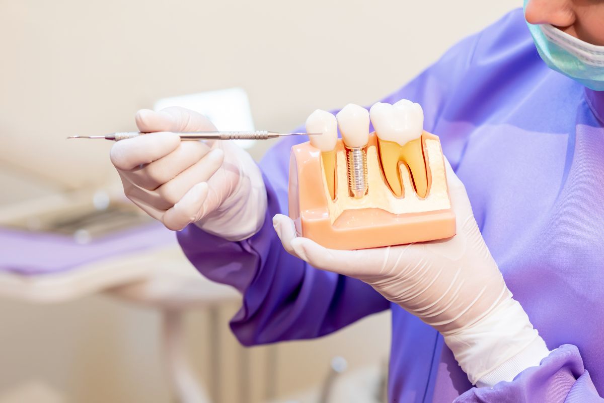 What to Expect During the Healing Process After Dental Implants
