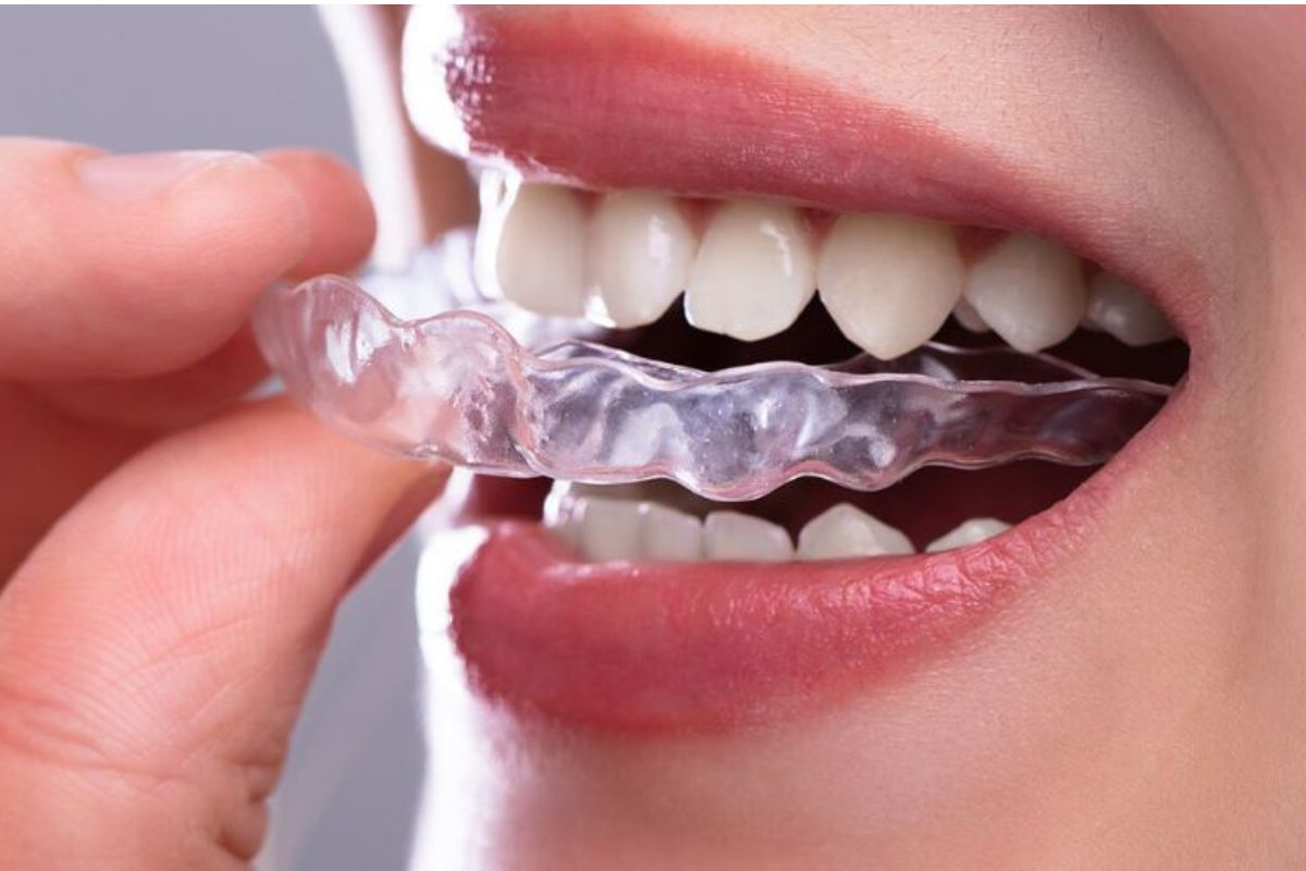 How to Care for Invisalign®?