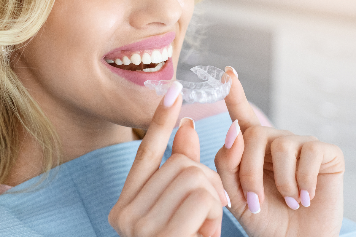 Invisalign for Busy Adults: What Plano Patients Should Know Before Starting