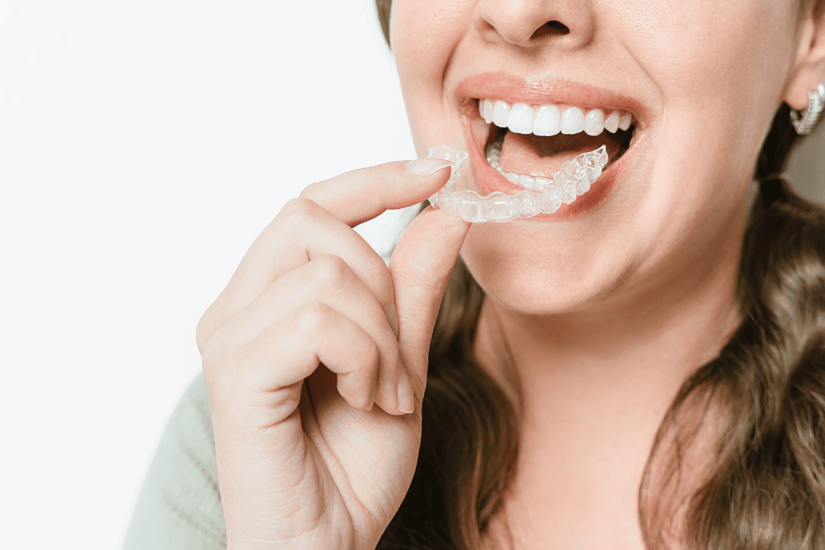 Can Invisalign Correct Teeth That Shifted After Braces?