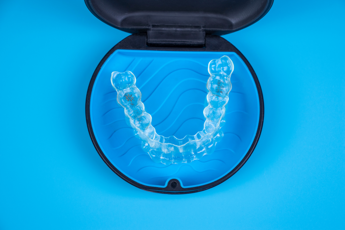 Do You Need Your Wisdom Teeth Removed Before Invisalign?