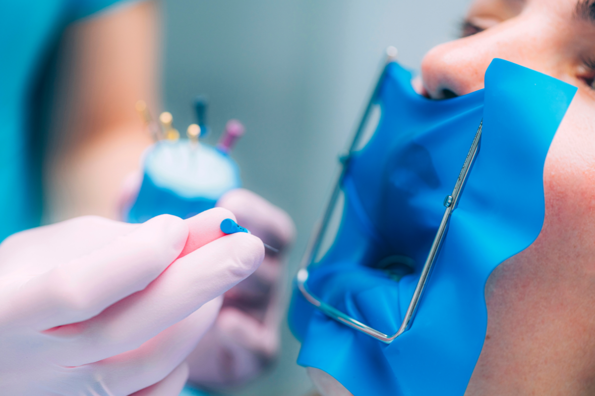 When Should You Call a Dentist About Pain After a Root Canal?