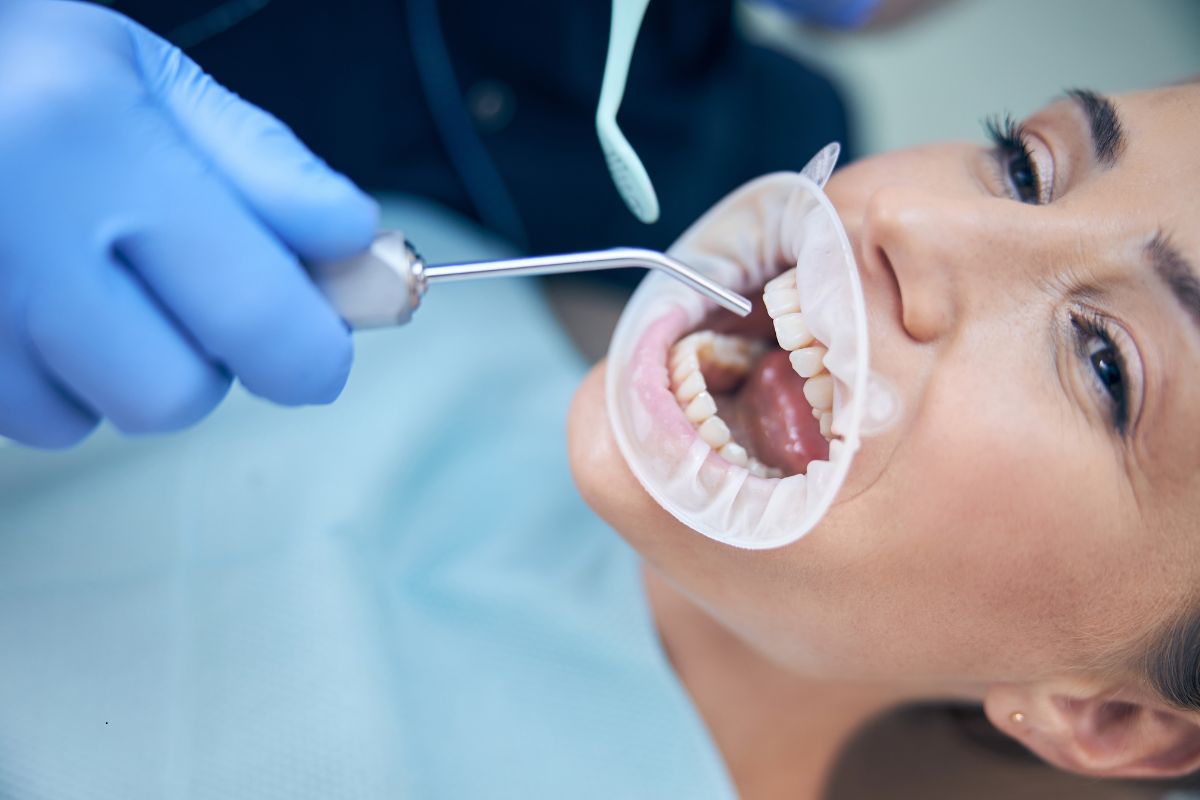 Beyond Strips: How Dentists Get Your Teeth So White
