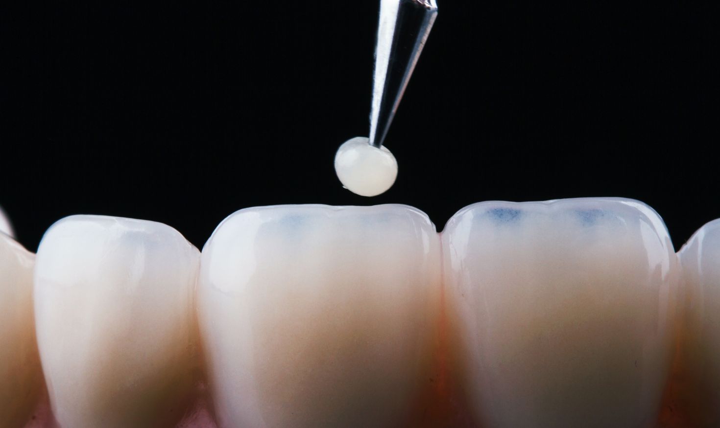How Restorative Dentistry Enhances Aesthetics and Function?