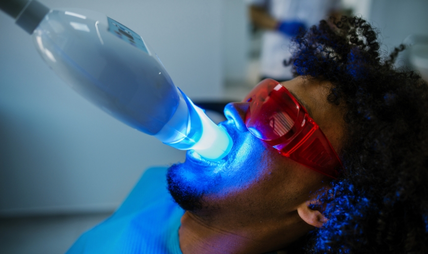 Why Investing in Teeth Whitening is Worth Every Penny