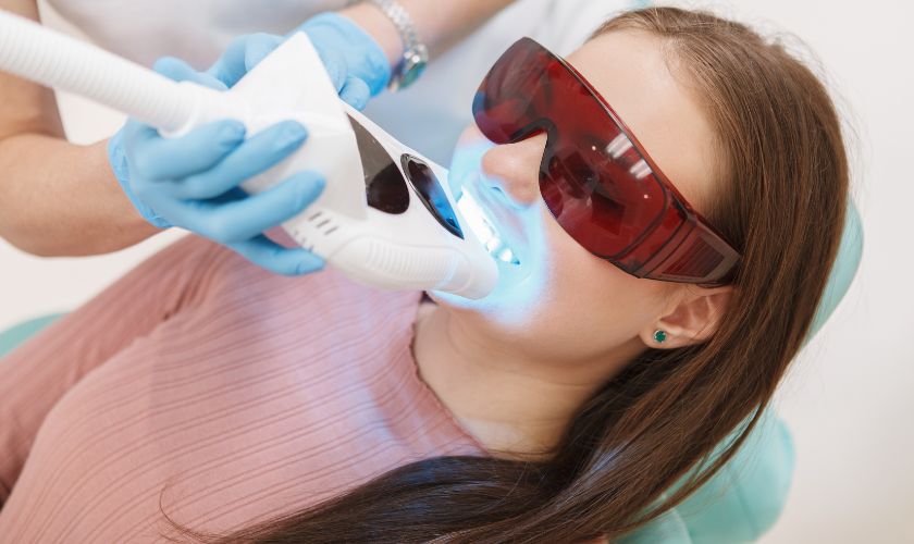 Why Professional Teeth Whitening Beats At-Home Treatments