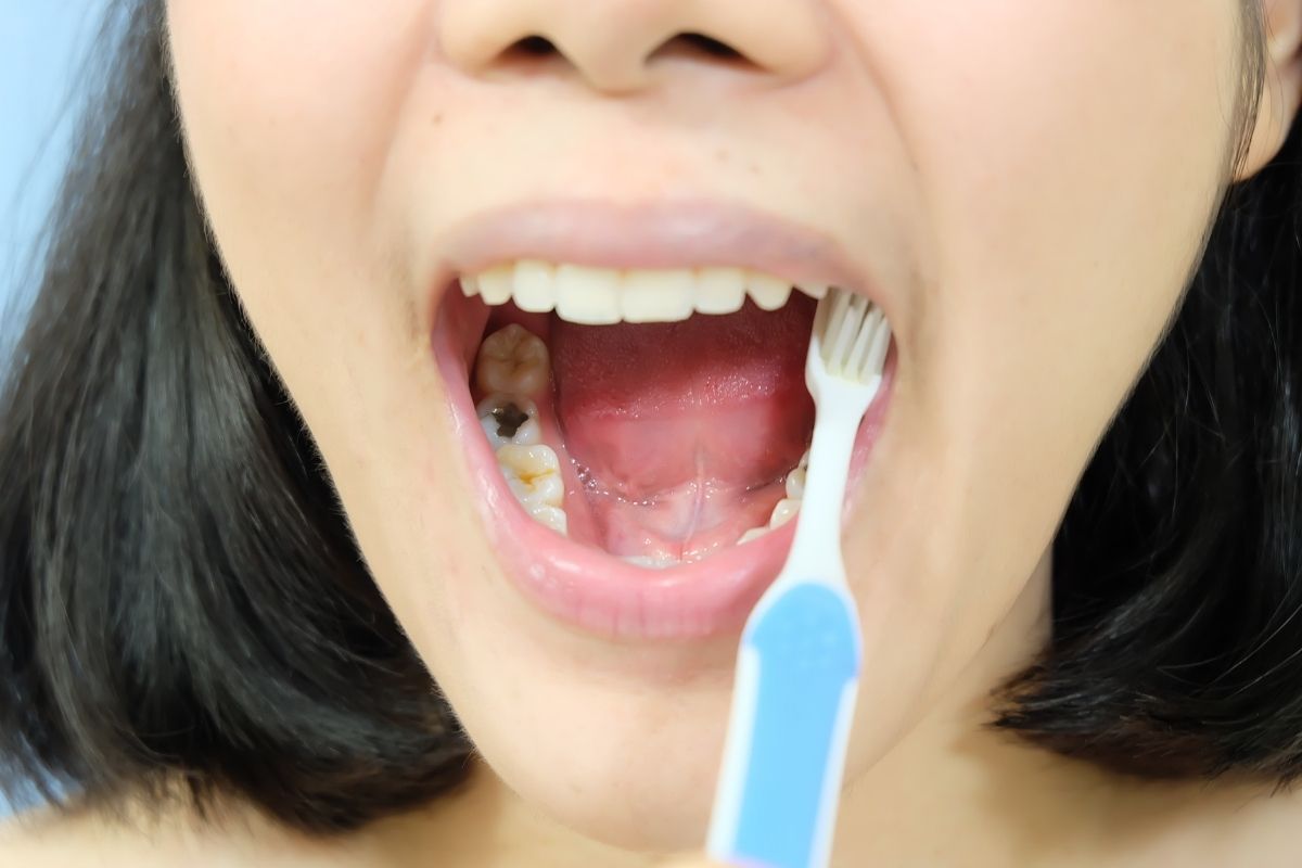 How Long Can You Skip Brushing? Lonestar dental group explains the Risks