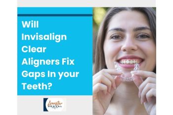 Will Invisalign Clear Aligners Fix Gaps In My Teeth