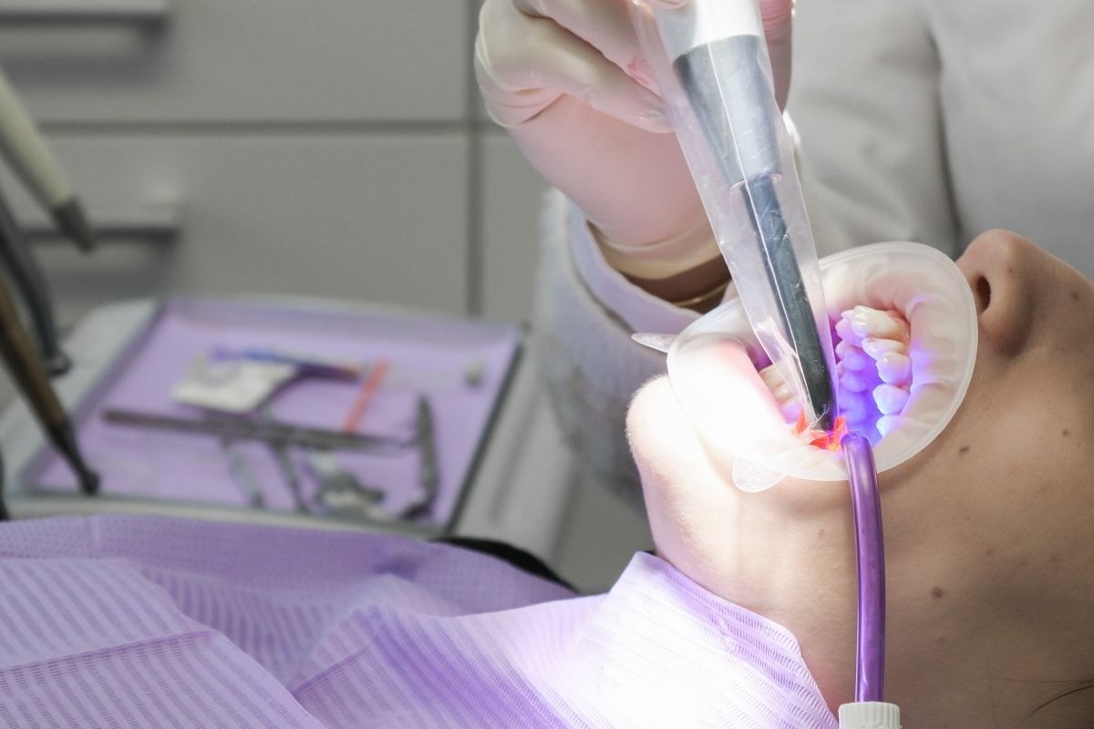 5 Factors That Affect the Lifespan of a Dental Bridge