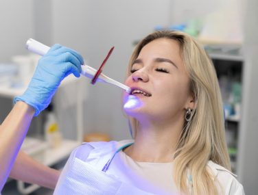 5 Facts About Teeth Whitening You Should Know