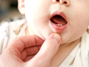 When Should Children Have Their First Dental Visit?