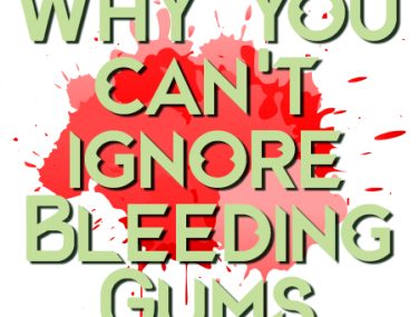 Why You Can’t Afford to Ignore Bleeding Gums