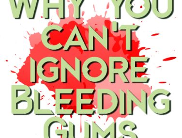 Why You Can’t Afford to Ignore Bleeding Gums