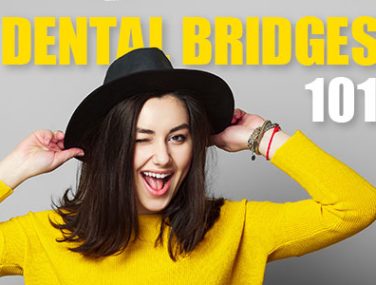 Dental Bridges 101