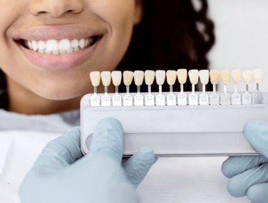 Why Choose Professional Teeth Whitening in Plano, TX for a Brighter Smile