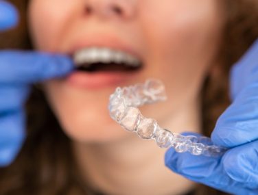 Correcting Gaps in Teeth with Invisalign