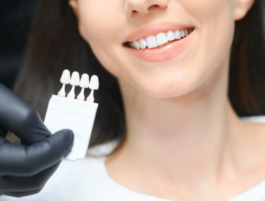 How Can Cosmetic Dentistry Transform Your Smile