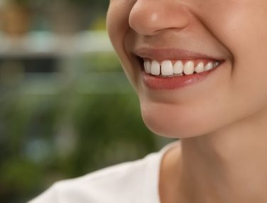How to Fix Spaces Between Your Front Teeth: Best Solutions