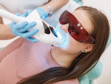 How Long Does Professional Teeth Whitening Last?