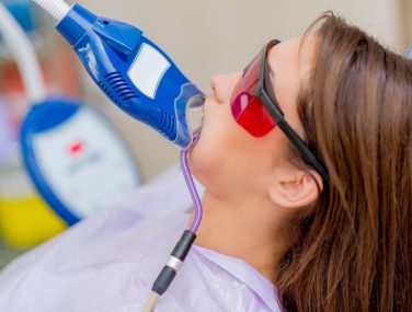 How Frequently Should You Whiten Your Teeth?