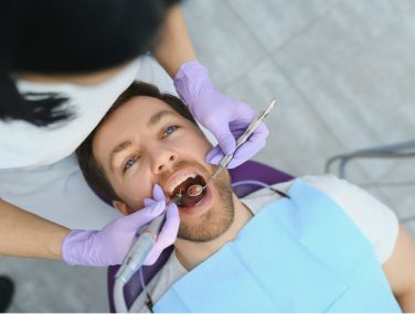 How Painful Are Dental Fillings? Myths vs. Reality Explained