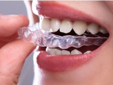 How to Care for Invisalign®?