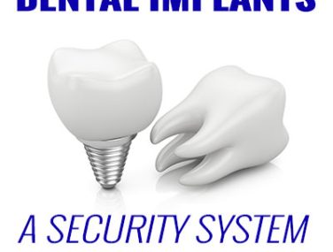 Dental Implants – A Security System for Your Smile