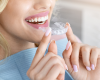 Invisalign Plano 1 rt6wke2gf7pocflokrggftnpqyqacaat1dqsv03wo0