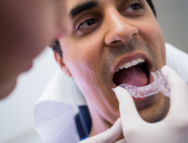 Invisalign and Wedding Preparation: Getting Your Perfect Smile in Plano