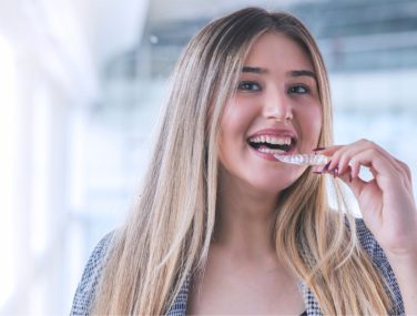 What Happens After Invisalign? The Next Steps for Your Smile