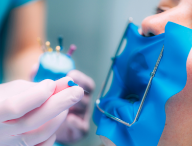 When Should You Call a Dentist About Pain After a Root Canal?
