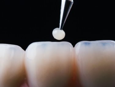 How Restorative Dentistry Enhances Aesthetics and Function?