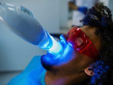 Why Investing in Teeth Whitening is Worth Every Penny