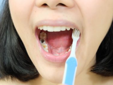 How Long Can You Skip Brushing? Lonestar dental group explains the Risks