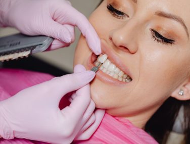 Veneers Can Give You Back Your Smile!