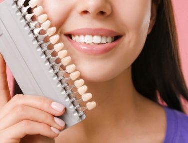 Shine Bright: Achieve Your Dream Smile with Veneers in Plano, TX