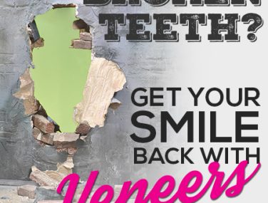 Veneers Can Give You Back Your Smile!