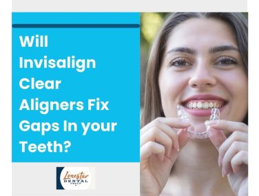 Will Invisalign Clear Aligners Fix Gaps In Your Teeth?