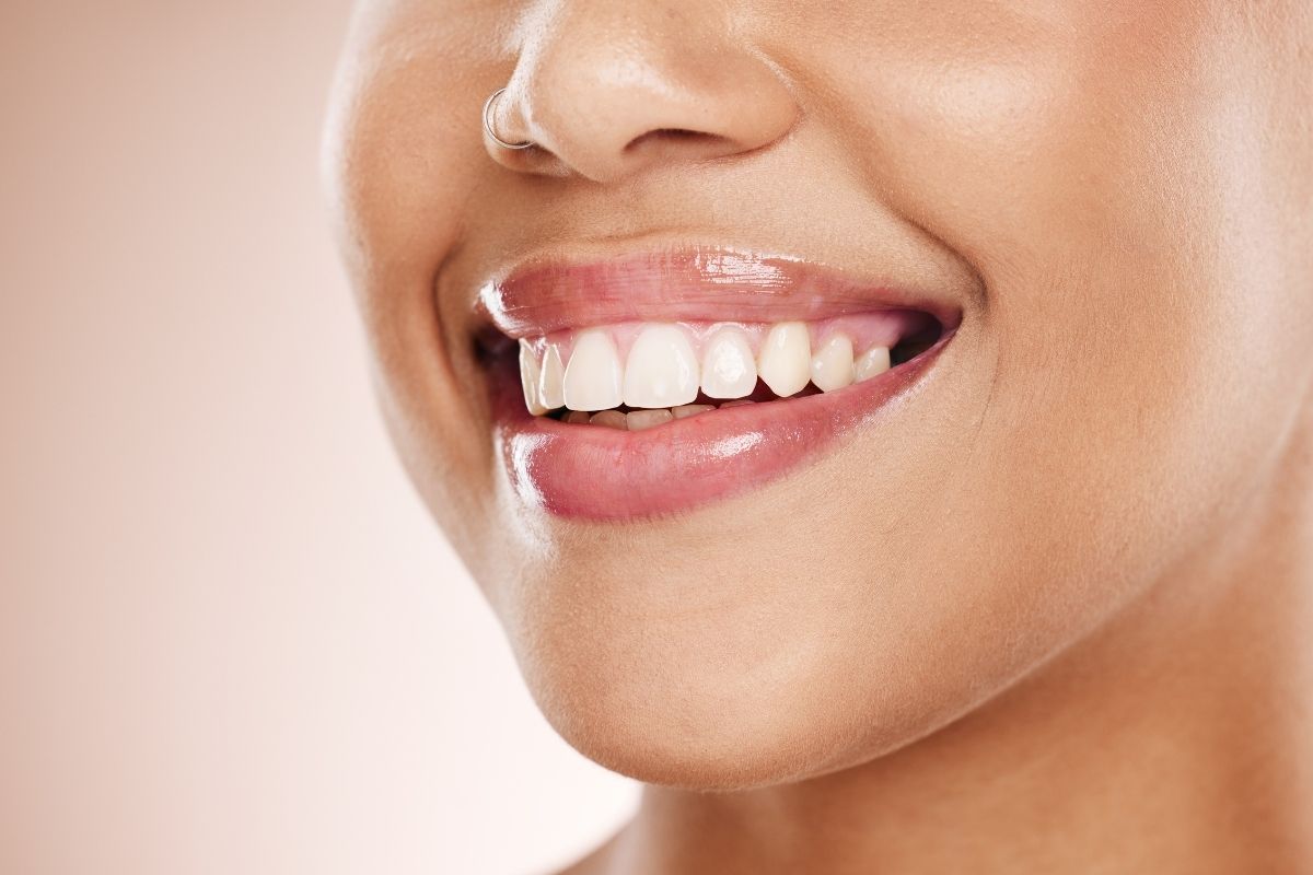 Is Tooth Bonding a Good Option? Everything You Need to Know