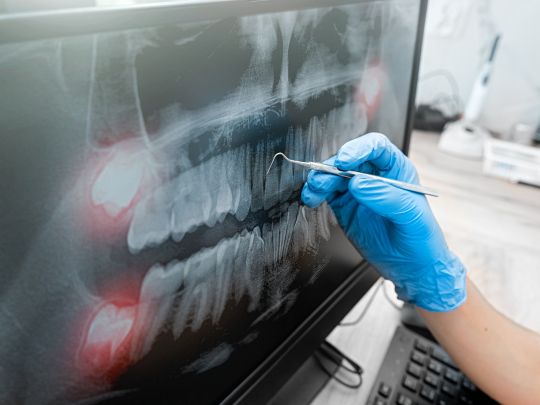 Can Oral Cancer Screenings Detect Other Dental Issues?